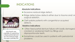JOURNAL CLUB PRESENTATION IN PROSTHODONTICS on ANDREW'S BRIDGE SYSTEM | PDF