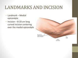 Approaches to the Elbow Joint | PPTX