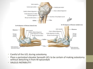 Approaches to the Elbow Joint | PPTX
