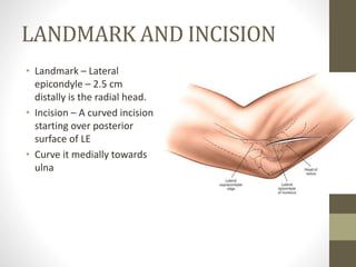 Approaches to the Elbow Joint | PPTX