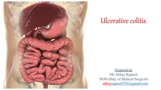 Ulcerative colitis
Prepared by
Mr.Abhay Rajpoot
HOD (Dep. of Medical Surgical)
abhayrajpoot5591@gmail.com
 