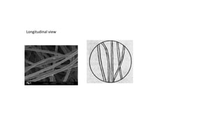 Longitudinal view
 