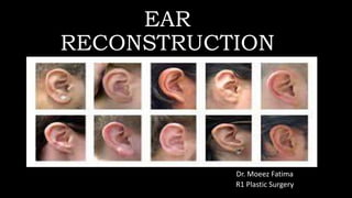 EAR
RECONSTRUCTION
Dr. Moeez Fatima
R1 Plastic Surgery
 