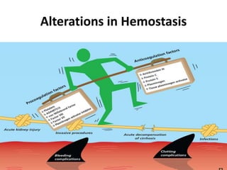 Alterations in Hemostasis
 