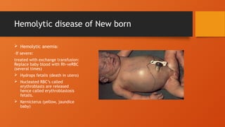 Hemolytic disease of New born
 Hemolytic anemia:
–If severe:
treated with exchange transfusion:
Replace baby blood with Rh-veRBC
(several times)
 Hydrops fetalis (death in utero)
 Nucleated RBC’s called
erythroblasts are released
hence called erythroblastosis
fetalis.
 Kernicterus (yellow, jaundice
baby)
 