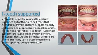 1-tooth supported
A complete or partial removable denture
supported by tooth or retained roots that is
intended to provide improve support, stability
and tactile and proprioceptive sensation and to
reduce ridge resorption. The tooth -supported
over denture is also called overlay denture,
telescopes denture and biological denture are
among the many terms used to define the
tooth-supported complete denture.
 