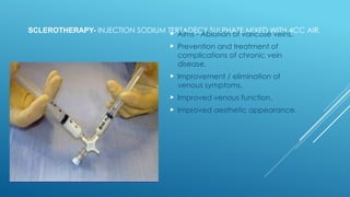 SCLEROTHERAPY- INJECTION SODIUM TERTADECY SULPHATE MIXED WITH 4CC AIR.
 Aims - Ablation of varicose veins.
 Prevention and treatment of
complications of chronic vein
disease.
 Improvement / elimination of
venous symptoms.
 Improved venous function.
 Improved aesthetic appearance.
 