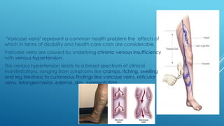 "Varicose veins" represent a common health problem the effects of
which in terms of disability and health care costs are considerable.
Varicose veins are caused by underlying chronic venous insufficiency
with venous hypertension.
This venous hypertension leads to a broad spectrum of clinical
manifestations, ranging from symptoms like cramps, itching, swelling
and leg tiredness to cutaneous findings like varicose veins, reticular
veins, telangiectasias, edema, skin pigmentation
 