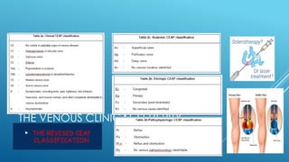 THE VENOUS CLINICAL SEVERITY
SCORE
 THE REVISED CEAP
CLASSIFICATION
 