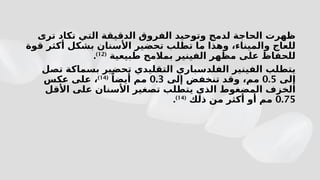 ‫ترى‬ ‫تكاد‬ ‫التي‬ ‫الدقيقة‬ ‫الفروق‬ ‫وتوحيد‬ ‫لدمج‬ ‫الحاجة‬ ‫ظهرت‬
‫قوة‬ ‫أكثر‬ ‫بشكل‬ ‫األسنان‬ ‫تحضير‬ ‫تطلب‬ ‫ما‬ ‫وهذا‬ ،‫والميناء‬ ‫للعاج‬
‫طبيعية‬ ‫بمالمح‬ ‫الفينير‬ ‫مظهر‬ ‫على‬ ‫للحفاظ‬
(
12
)
.
‫الفل‬ ‫الفينير‬ ‫يتطلب‬
‫د‬
‫ت‬ ‫التقليدي‬ ‫سباري‬
‫حضير‬
‫ب‬
‫تصل‬ ‫سماكة‬
‫إلى‬
0.5
‫إلى‬ ‫تنخفض‬ ‫وقد‬ ،‫مم‬
0.3
ً‫أيضا‬ ‫مم‬
(
14
)
‫عكس‬ ‫على‬ ،
‫األقل‬ ‫على‬ ‫األسنان‬ ‫تصغير‬ ‫يتطلب‬ ‫الذي‬ ‫المضغوط‬ ‫الخزف‬
0.75
‫ذلك‬ ‫من‬ ‫أكثر‬ ‫أو‬ ‫مم‬
(
14
)
.
 