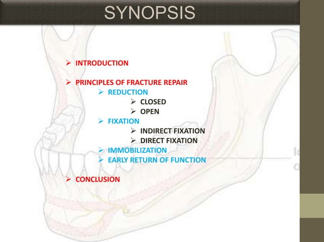 MANAGEMENT OF MAXILLOFACIAL FRACTURES | PPTX