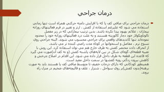 ‫جراحي‬ ‫درمان‬
‫درمان‬‫زماني‬ ‫تنها‬ ‫است‬ ‫همراه‬ ‫حركتي‬ ‫دامنه‬ ‫افزايش‬ ‫با‬ ‫كه‬ ‫پا‬ ‫كف‬ ‫صافي‬ ‫براي‬ ‫جراحي‬
‫ر‬ ‫فعاليتهاي‬ ‫فرم‬ ‫در‬ ‫تغيير‬ ‫و‬ ‫ارتز‬ ، ‫كفش‬ ‫از‬ ‫استفاده‬ ‫عليرغم‬ ‫كه‬ ‫شود‬ ‫مي‬ ‫استفاده‬‫وزانه‬
‫باشد‬ ‫نكرده‬ ‫پيدا‬ ‫بهبود‬ ‫عالئم‬ ، ‫بيماران‬.‫مفصل‬ ‫زير‬ ‫در‬ ‫كه‬ ‫بيماراني‬ ‫ترتيب‬ ‫بدين‬
‫محدود‬ ‫را‬ ‫خود‬ ‫روزانه‬ ‫فعاليتهاي‬ ‫درد‬ ‫علت‬ ‫به‬ ‫و‬ ‫هستند‬ ‫كالوزيته‬ ‫دچار‬ ‫خود‬ ‫تالوناويكوالر‬
‫شوند‬ ‫مي‬ ‫محسوب‬ ‫جراحي‬ ‫براي‬ ‫واقعي‬ ‫كانديدهاي‬ ‫تنها‬ ‫اند‬‫نموده‬.‫روي‬ ‫جراحي‬ ‫البته‬
‫باشد‬ ‫مي‬ ‫تر‬ ‫كننده‬ ‫راضي‬ ‫مدت‬ ‫كوتاه‬ ‫در‬ ‫استخوانها‬ ‫و‬ ‫مفاصل‬ ، ‫نرم‬ ‫نسوج‬.
‫كرد‬ ‫استفاده‬ ‫توان‬ ‫مي‬ ‫هم‬ ‫خارج‬ ‫طرف‬ ‫به‬ ‫كفش‬ ‫مختصر‬ ‫دادن‬ ‫انحراف‬ ‫از‬.‫با‬ ‫روش‬ ‫اين‬
‫كفش‬ ‫پاشنه‬ ‫هاي‬‫اليه‬ ‫بين‬ ‫در‬ ‫شكل‬ ‫اي‬‫گوه‬ ‫اي‬‫قطعه‬ ‫تعبيه‬(‫آن‬ ‫كف‬ ‫نه‬ ‫و‬)‫گ‬ ‫مي‬ ‫صورت‬‫يرد‬
‫شود‬ ‫مي‬ ‫داده‬ ‫قرار‬ ‫داخل‬ ‫طرف‬ ‫به‬ ‫قطعه‬ ‫اين‬ ‫قاعده‬ ‫كه‬.‫و‬ ‫چرخش‬ ‫اصالح‬ ‫در‬ ‫اقدام‬ ‫اين‬
‫است‬ ‫مفيد‬ ‫داخل‬ ‫سمت‬ ‫در‬ ‫كفشها‬ ‫رويه‬ ‫زدگي‬ ‫بيرون‬ ‫كاهش‬.
‫ص‬ ‫به‬ ‫بايد‬ ‫هستند‬ ‫پا‬ ‫كف‬ ‫صافي‬ ‫متوسط‬ ‫تا‬ ‫خفيف‬ ‫درجات‬ ‫داراي‬ ‫كه‬ ‫كودكاني‬ ‫همينطور‬‫ورت‬
‫برهنه‬(‫كفش‬ ‫بدون‬)‫راه‬ ‫منزل‬ ‫در‬ ‫ضخيم‬ ‫هاي‬‫قاليچه‬ ‫و‬ ‫علف‬ ، ‫شنزار‬ ، ‫سواحل‬ ‫روي‬ ‫بر‬
‫بروند‬.
 