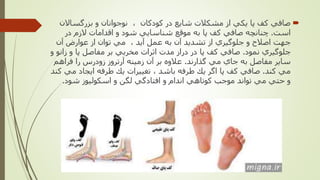 ‫بزرگساالن‬ ‫و‬ ‫نوجوانان‬ ، ‫كودكان‬ ‫در‬ ‫شايع‬ ‫مشكالت‬ ‫از‬ ‫يكي‬ ‫پا‬ ‫كف‬ ‫صافي‬
‫است‬.‫در‬ ‫الزم‬ ‫اقدامات‬ ‫و‬ ‫شود‬ ‫شناسايي‬ ‫موقع‬ ‫به‬ ‫پا‬ ‫كف‬ ‫صافي‬ ‫چنانچه‬
‫آن‬ ‫عوارض‬ ‫از‬ ‫توان‬ ‫مي‬ ، ‫آيد‬ ‫عمل‬ ‫به‬ ‫آن‬ ‫تشديد‬ ‫از‬ ‫جلوگيري‬ ‫و‬ ‫اصالح‬ ‫جهت‬
‫نمود‬ ‫جلوگيري‬.‫زان‬ ‫و‬ ‫پا‬ ‫مفاصل‬ ‫بر‬ ‫مخربي‬ ‫اثرات‬ ‫مدت‬ ‫دراز‬ ‫در‬ ‫پا‬ ‫كف‬ ‫صافي‬‫و‬ ‫و‬
‫گذارند‬ ‫مي‬ ‫جاي‬ ‫به‬ ‫مفاصل‬ ‫ساير‬.‫فراهم‬ ‫را‬ ‫زودرس‬ ‫آرتروز‬ ‫زمينه‬ ‫آن‬ ‫بر‬ ‫عالوه‬
‫كند‬ ‫مي‬.‫مي‬ ‫ايجاد‬ ‫طرفه‬ ‫يك‬ ‫تغييرات‬ ، ‫باشد‬ ‫طرفه‬ ‫يك‬ ‫اگر‬ ‫پا‬ ‫كف‬ ‫صافي‬‫كند‬
‫شود‬ ‫اسكوليوز‬ ‫و‬ ‫لگن‬ ‫افتادگي‬ ‫و‬ ‫اندام‬ ‫كوتاهي‬ ‫موجب‬ ‫تواند‬ ‫مي‬ ‫حتي‬ ‫و‬.
 