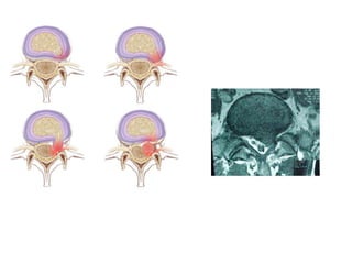 radiological signs of in orthopaedics | PPTX