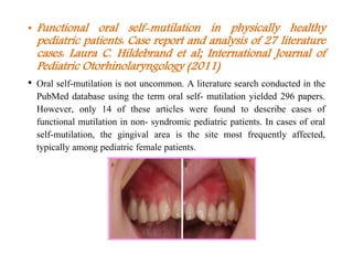• Functional oral self-mutilation in physically healthy
pediatric patients: Case report and analysis of 27 literature
cases: Laura C. Hildebrand et al; International Journal of
Pediatric Otorhinolaryngology (2011)
• Oral self-mutilation is not uncommon. A literature search conducted in the
PubMed database using the term oral self- mutilation yielded 296 papers.
However, only 14 of these articles were found to describe cases of
functional mutilation in non- syndromic pediatric patients. In cases of oral
self-mutilation, the gingival area is the site most frequently affected,
typically among pediatric female patients.
 