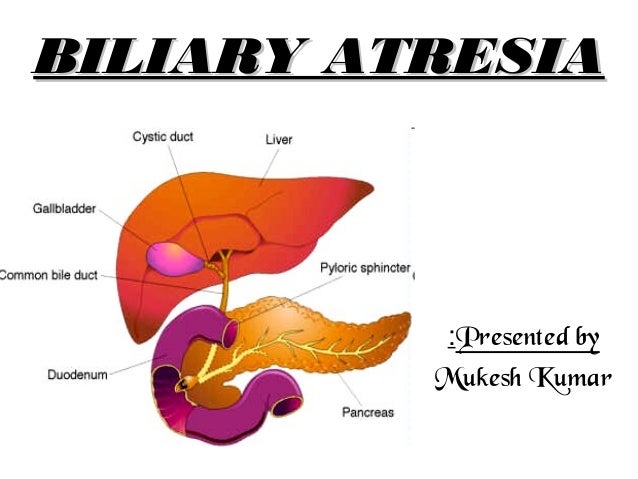biliary atresia