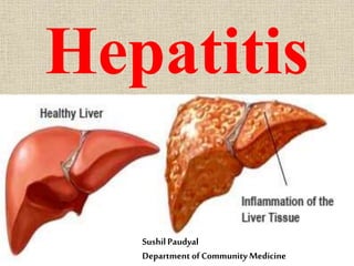 Hepatitis
SushilPaudyal
Department ofCommunity Medicine
 