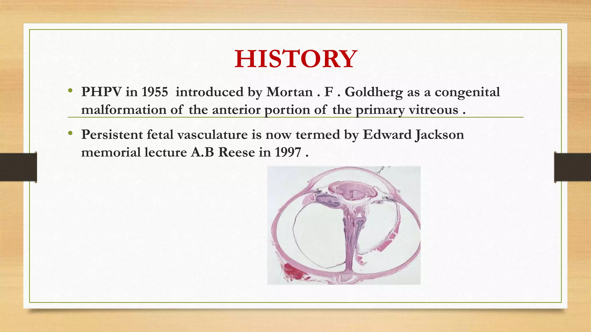 Pphpv Eye PERSISTENT HYPERPLASTIC PRIMARY VITREOUS | PPTX
