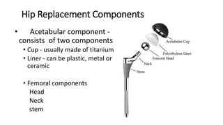 Hip Replacement Components
• Acetabular component -
consists of two components
• Cup - usually made of titanium
• Liner - can be plastic, metal or
ceramic
• Femoral components
Head
Neck
stem
 