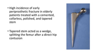 • High incidence of early
periprosthetic fracture in elderly
patients treated with a cemented,
collarless, polished, and tapered
stem
• Tapered stem acted as a wedge,
splitting the femur after a direct hip
contusion
 
