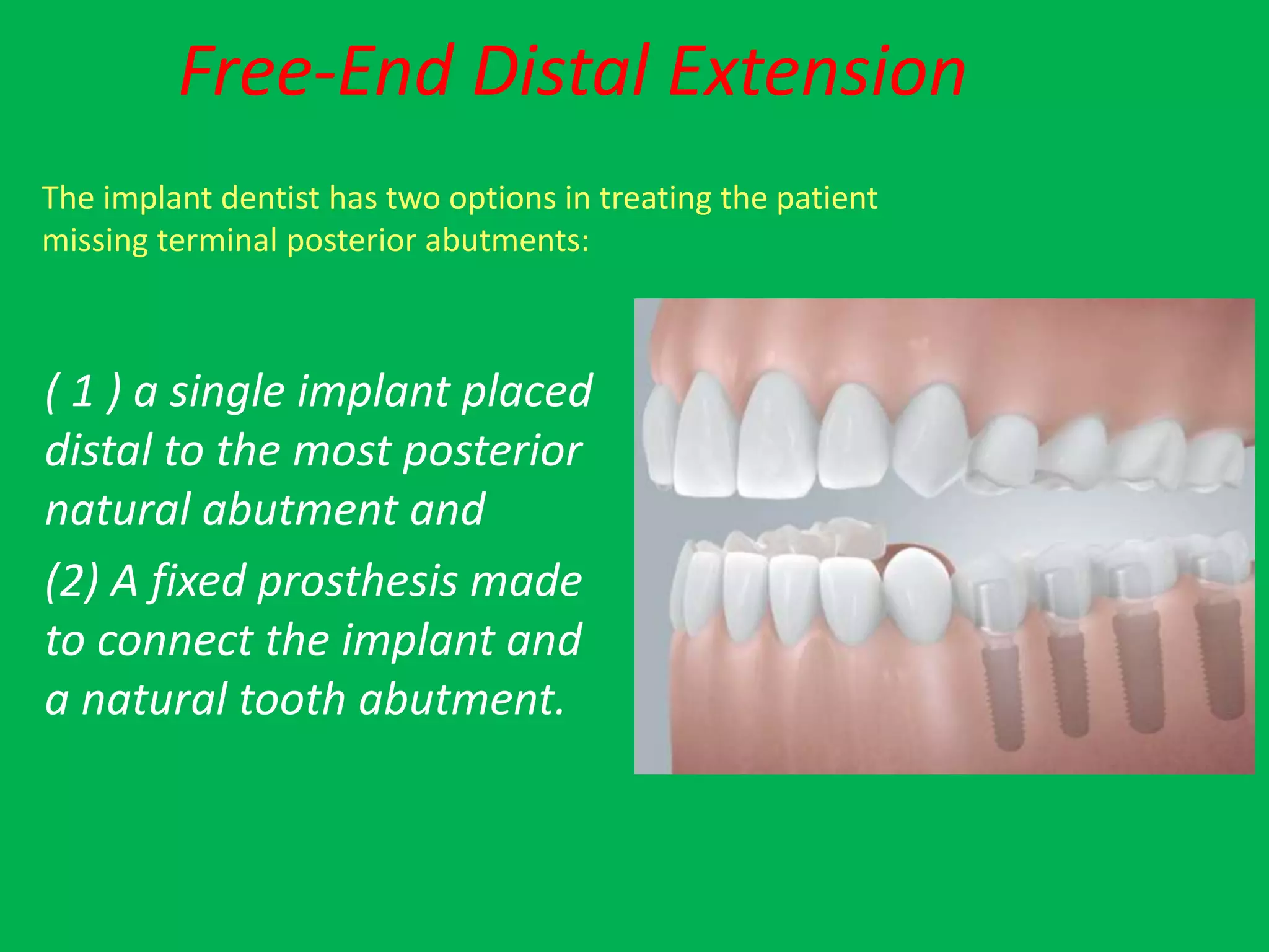 implant supported fixed restorations | PPTX