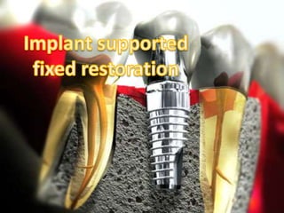 implant supported fixed restorations