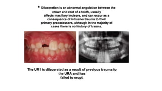 management of the developing dentition part 1 | PPTX