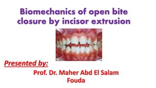 Prof. Dr. Maher Abd El Salam
Fouda
Biomechanics of open bite
closure by incisor extrusion
Presented by:
 