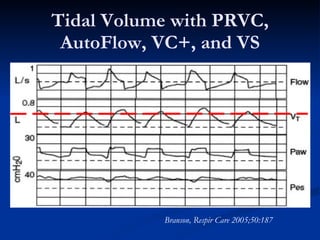 New Ventilator Modes: Do They Help? | PPT