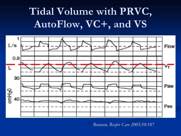prvc