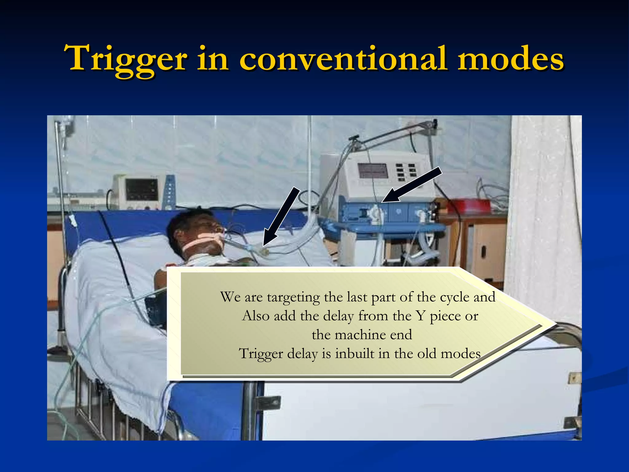 Trigger in conventional modes We are targeting the last part of the cycle and  Also add the delay from the Y piece or the machine end Trigger delay is inbuilt in the old modes 