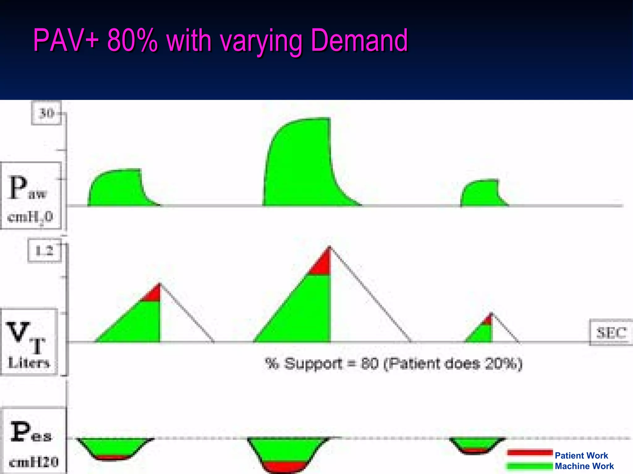 PAV+ 80% with varying Demand Patient Work Machine Work 