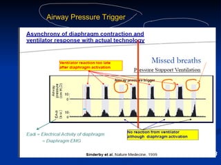 Sinderby et al, Nature Med 1999;5:1433 Time (s) 0 1 4 3 2 0 1 4 3 2 Airway Pressure Trigger Onset of diaphragmatic electrical activity Onset of ventilator flow Neural Trigger 0 20 -5.0 0.0 0.0 0.5 -1 0 1 Flow (l/s) Volume (l) P es (cm H 2 O) P aw (cm  H 2 O ) Missed breaths 