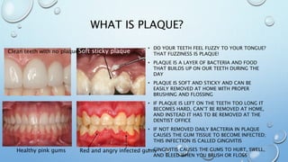 New national children's dental health month [autosaved] | PPTX