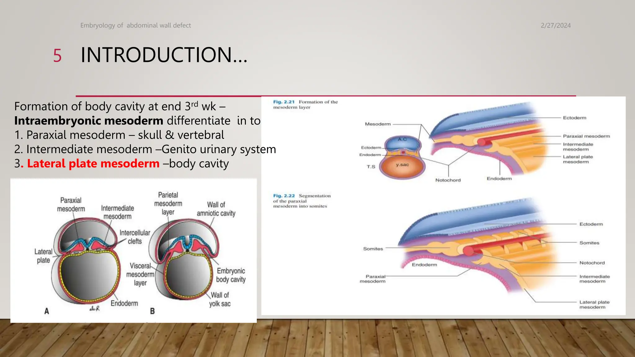new new TEGENE,JIMMA, ETHIOPIAN CONGENITAL ABDOMINAL WALL DEFECT | PPTX