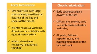 Acute Intoxication
 Dry, scaly skin, with large
areas of desquamation and
fissuring of the lips and
angles of the mouth.
 Infants: nausea & vomiting,
drowsiness or irritability with
signs of increased ICP
 Adults: drowsiness,
irritability, headache &
vomiting
Chronic intoxication
 Early cutaneous sign is
dryness of the lips
 Diffuse, dry, pruritic, scaly
skin with peeling of palms
and soles,
 Alopecia, follicular
hyperkeratosis, and
hyperpigmentation of the
face and neck.
 