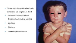 • Classic triad dermatitis, diarrhea &
dementia, can progress to death
• Peripheral neuropathy with
dysesthesias, including burning
• Lassitude
• Dizziness
• Irritability, disorientation
 