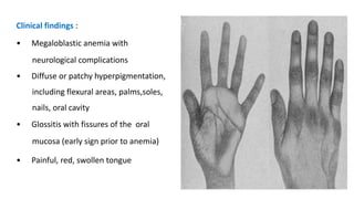 Clinical findings :
• Megaloblastic anemia with
neurological complications
• Diffuse or patchy hyperpigmentation,
including flexural areas, palms,soles,
nails, oral cavity
• Glossitis with fissures of the oral
mucosa (early sign prior to anemia)
• Painful, red, swollen tongue
 