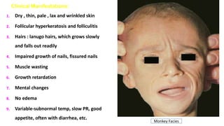 Clinical Manifestations:
1. Dry , thin, pale , lax and wrinkled skin
2. Follicular hyperkeratosis and folliculitis
3. Hairs : lanugo hairs, which grows slowly
and falls out readily
4. Impaired growth of nails, fissured nails
5. Muscle wasting
6. Growth retardation
7. Mental changes
8. No edema
9. Variable-subnormal temp, slow PR, good
appetite, often with diarrhea, etc.
Monkey Facies
 