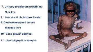 7. Urinary urea/gram creatinine
N or low
8. Low zinc & cholesterol levels
9. Glucose tolerance curves
diabetic type
10. Bone growth delayed
11. Liver biopsy N or atrophic
 