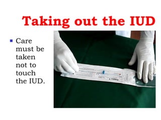 Taking out the IUD Care must be taken not to touch the IUD. 