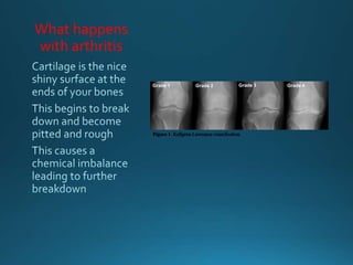What happens
with arthritis
 