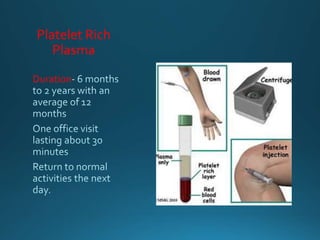 Platelet Rich
Plasma
Duration
 