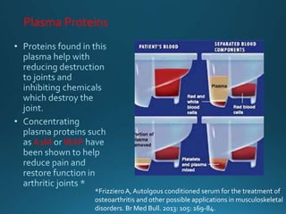 Plasma Proteins
A2M IRAP
*FrizzieroA, Autolgous conditioned serum for the treatment of
osteoarthritis and other possible applications in musculoskeletal
disorders. Br Med Bull. 2013: 105: 169-84.
 