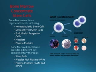 Bone Marrow
Concentrate
Stem Cells
 