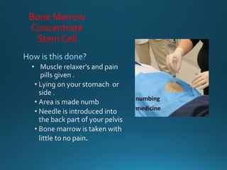 Bone Marrow
Concentrate
Stem Cell
 