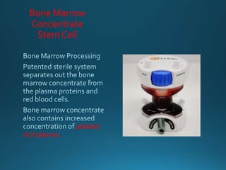 Bone Marrow
Concentrate
Stem Cell
platelet
rich plasma.
 