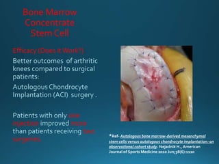 Bone Marrow
Concentrate
Stem Cell
Efficacy (Does itWork?)
one
injection more
two
surgeries.
*Ref- Autologous bone marrow-derived mesenchymal
stem cells versus autologous chondrocyte implantation: an
observational cohort study. Nejadnik H., American
Journal of Sports Medicine 2010 Jun;38(6):1110
 