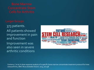 Bone Marrow
Concentrate Stem
Cells for Arthritis
Larger Groups
Centeno, C et al, A dose response analysis of a specific bone marrow concentrate treatment protocol for knee
osteoarthritis, BMC Musculoskelet Disord. 2015; 16:258
 