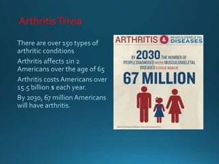 ArthritisTrivia
 